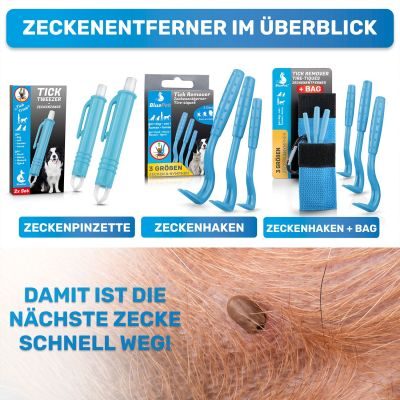 Thumbnail 4: BluePet 2x Zeckenzange, Zeckenentferner - Tick tweezer - Zeckenpinzette - Zeckenzieher - 2er-Set - automatisches Greifen durch Knopf drücken/lösen
