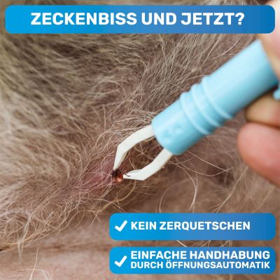 Thumbnail 5: BluePet 2x  Zeckenzange, Zeckenentferner - Tick tweezer - Zeckenpinzette - Zeckenzieher - 2er-Set - automatisches Greifen durch Knopf drücken/lösen