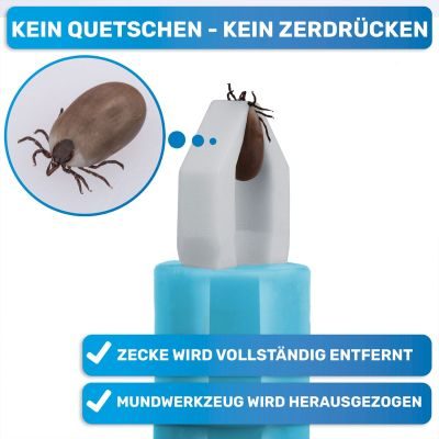Thumbnail 2: BluePet 2x  Zeckenzange, Zeckenentferner - Tick tweezer - Zeckenpinzette - Zeckenzieher - 2er-Set - automatisches Greifen durch Knopf drücken/lösen