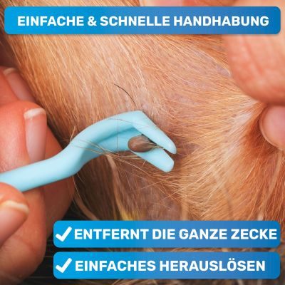 Thumbnail 2: BluePet 3er Set Zeckenhaken/ Zeckenhebel für Hunde, Katzen, Pferde & Mensch I Zeckenentferner I Alternative zu Zeckenpinzette, Zeckenzange, Zeckenschutzmittel